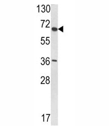 Western blot analysis of VDU1 antibody and T47D lysate.