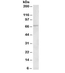 Western blot testing of human heart lysate with ACADVL antibody at 1ug/ml. Predicted molecular weigh