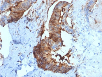 CTSD Antibody / Cathepsin D