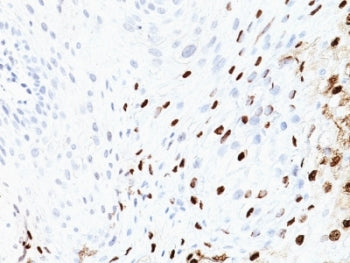 HPV-16 L1 Antibody