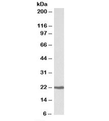 CBFB Antibody