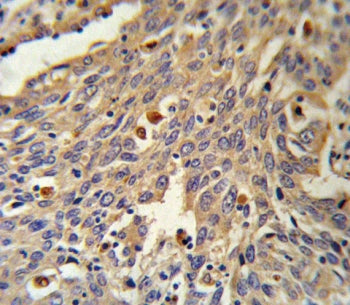 Galactosidase alpha Antibody / Gla