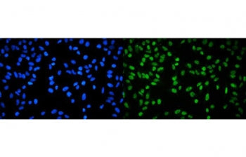 RPA32 Antibody / Replication Protein A2