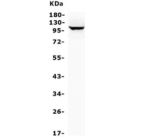 MTTP Antibody / MTP