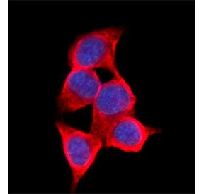 AKR1C1/2 Antibody