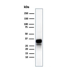 Recombinant GZMB Antibody / Granzyme B