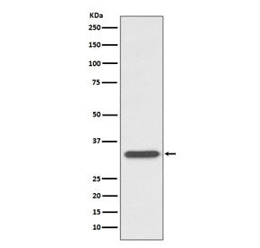 CD74 / CLIP Antibody