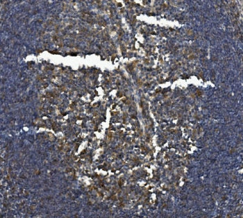 IHC staining of FFPE rat intestine with Il-3rb antibody. HIER: boil tissue sections in pH8 EDTA for 