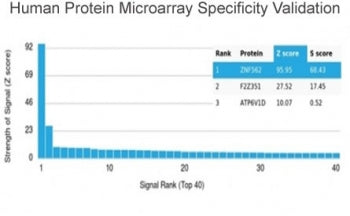 ZNF562 Antibody