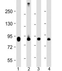 Western blot testing of human 1) HeLa, 2) Jurkat, 3) COS-7 and 4) mouse heart lysate with PFKP antib