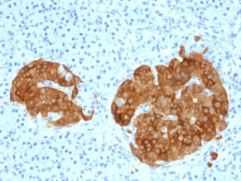 GAD65 Antibody