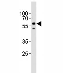ALK2 Antibody