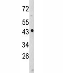 NDRG1 Antibody