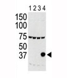 Aurora-C Antibody (AURKC)