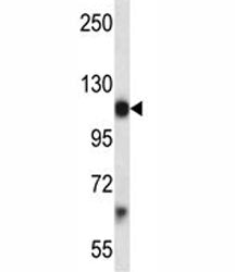 Platelet Derived Growth Factor Receptor alpha Antibody (PDGFRA)