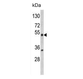 NR1I2 Antibody / PXR