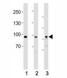 Western blot testing of PROX1 antibody at 1:1000 dilution. Lane 1: human heart lysate; 2: mouse brai