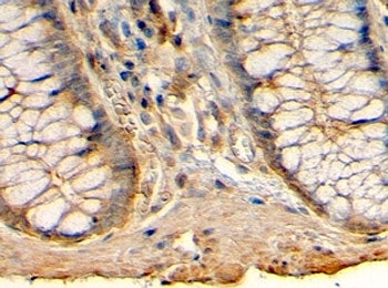 IHC testing of FFPE human colon with HRH1 antibody at 4ug/ml. HIER: steamed with pH6 citrate buffer,