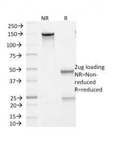 BRAF V600E Antibody