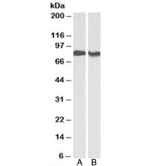PRKCB Antibody