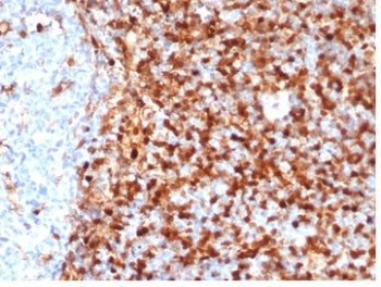 IHC staining of FFPE human tonsil tissue with ANXA1 antibody (clone rANXA1/6451). HIER: boil tissue 