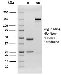 CD79b Antibody