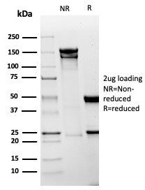 Mesothelin Antibody / MSLN