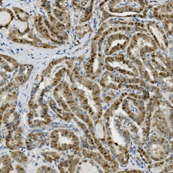 TKT Antibody / Transketolase