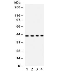 Parvin alpha Antibody / PARVA