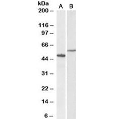 Western blot testing of human hippocampus [A] and HeLa [B] lysates with CD47 antibody at 0.3ug/ml. P