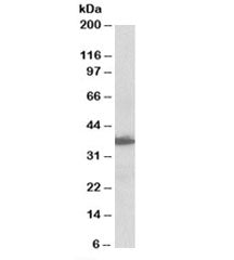 AIMP1 Antibody