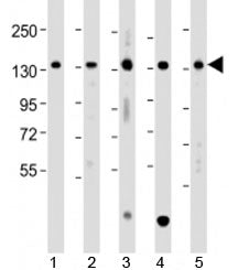 Western blot testing of human 1) A431, 2) HCT116, 3) Jurkat, 4) K562 and 5) U-2OS cell lysate with T