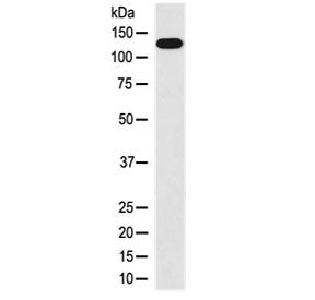 MYLK Antibody / MLCK