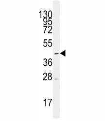 MCT1 Antibody (SLC16A1)