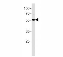 AKT Antibody