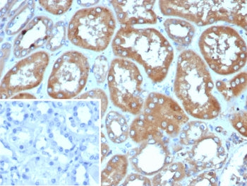 DBC2 Antibody / Deleted in breast cancer gene 2 / RHOBTB2