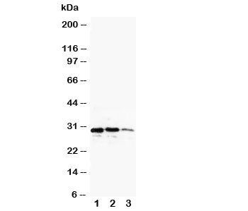 Western blot testing of CUEDC2 antibody and recombinant protein, 29KD with tag; Lane 1: 10ng; 2: 5ng; 3: 2.5ng; 4: 1.25ng