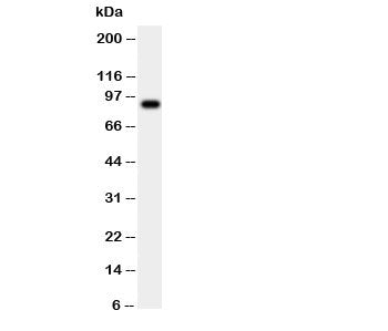 CSF3R Antibody / Colony Stimulating Factor 3 Receptor
