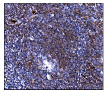 IHC staining of FFPE human tonsil tissue with Toll-like receptor 8 antibody. HIER: boil tissue secti