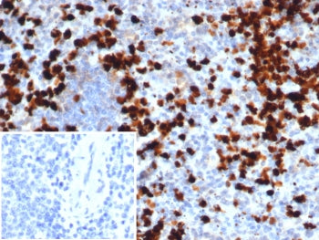S100A9 Antibody / MRP14 / Calgranulin B / Calprotectin L1H