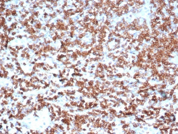 IHC staining of FFPE human tonsil tissue with CD39 antibody (clone CD39/6860). HIER: boil tissue sec