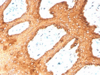 Type II Cytokeratin Antibody (CK1-8)