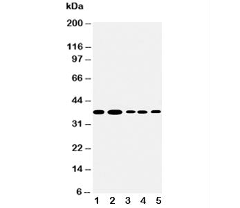 Angiopoietin 2 Antibody