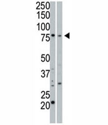 cGKI beta Antibody