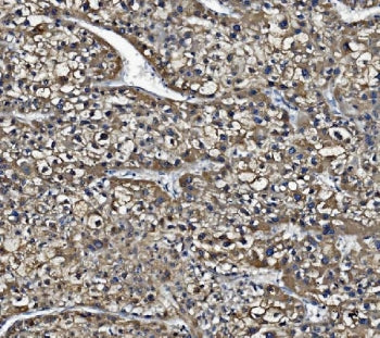 CES1 Antibody / Carboxylesterase 1