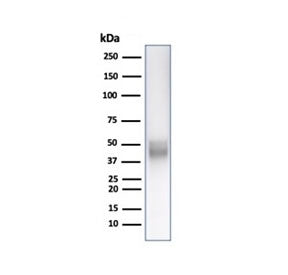 Western blot testing of human Jurkat cell lysate with CD5 antibody. Observed molecular weight: 55~67