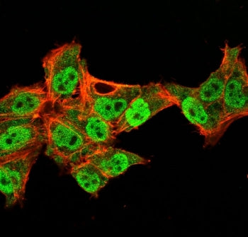 Immunofluorescent staining of PFA-fixed human HeLa cells with recombinant p40 antibody (clone TP40/3