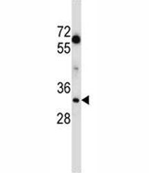 LDHA Antibody