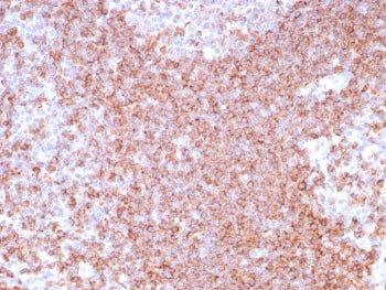 IHC staining of FFPE human tonsil tissue with CD39 antibody (clone CD39/8538R). HIER: boil tissue se