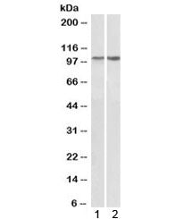 Western blot testing of 1) human heart and 2) mouse heart lysate with ITGA3 antibody at 1ug/ml. Expe